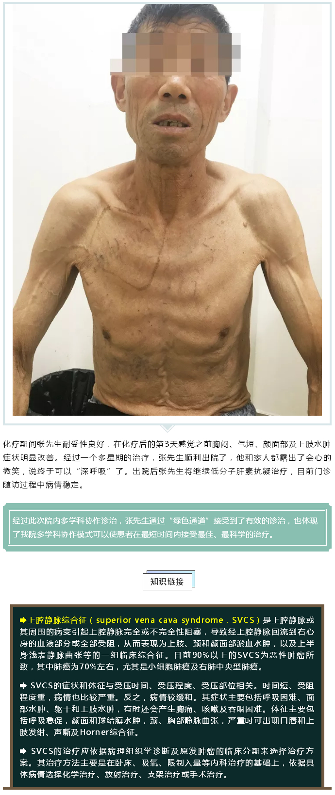 2019-09-24 肿瘤中心 --- “深呼吸 享受清新的氧气”——记潞河医院肿瘤中心成功救治一例“上腔静脉综合征”患者---2.jpg